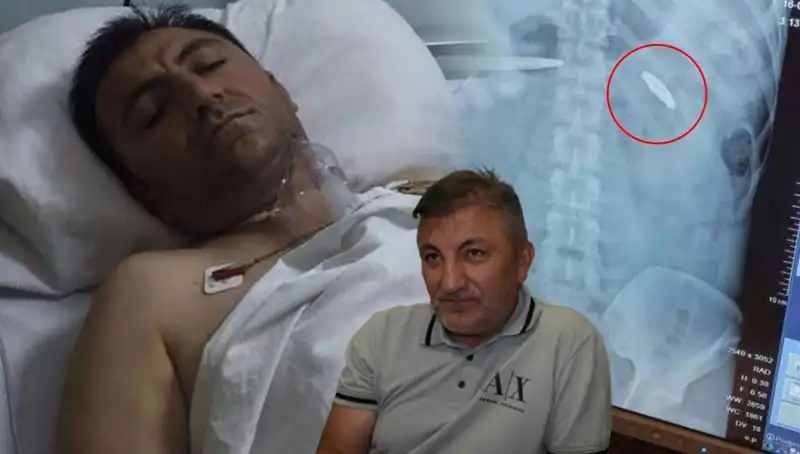 15 Temmuz'un Karanlık Gecesi: Kurşunla Taşınan Acı Anılar