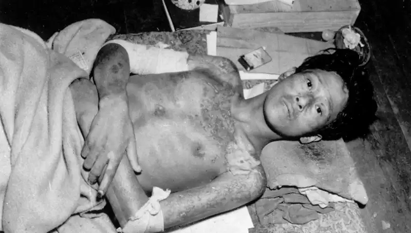 Nagasaki’nin 80. Yıldönümünde Acil Uyarı: Nükleer Endişeler Yeniden Alevleniyor